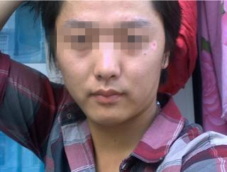 马春林：有效预防白癜风的好方法有哪些?(图1)