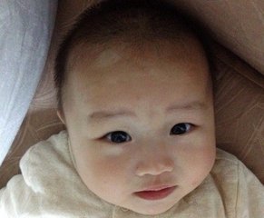 马春林：白癜风患者会遗传给下一代吗?(图1)